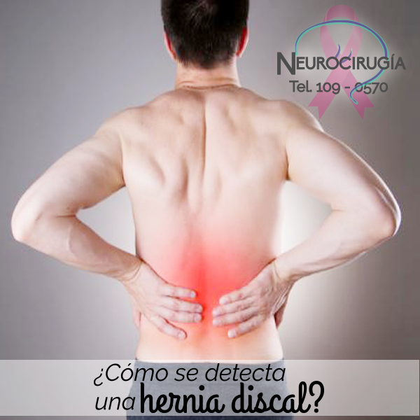 ¿cómo Se Detecta Una Hernia Discal Neuro Gomezemk 2245